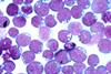 Epstein-barr_virus_(ebv) (1)