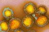 Colorful_photo_of_influenza_particles.webp