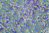 Eubacteria_(26_2_87)_Bacillus_subtilis;_spores_stained_green