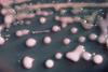 Klebsiella_pneumoniae_01 (1)