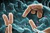 Pseudomonas