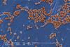 Methicillin-resistant_Staphylococcus_aureus_10048 (1)
