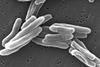 Mycobacterium_tuberculosis