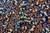 Novel_Coronavirus_SARS-CoV-2_(49680384436)