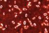 Капсула_Klebsiella_Pneumoniae