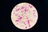 Nontuberculous_Mycobacteria_(NTM)_in_Ziehl-Neelsen_Staining_from_Positive_MGIT_Culture (1)