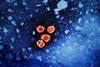 Hepatitis_B_Virus_(52444068124)