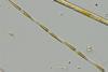 Low-Res_Image_503_Pseudo-nitzschia_CW_PML