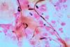 Candida_Gram_stain