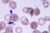 Plasmodium