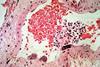 CSIRO_ScienceImage_321_Cross_Section_of_Blood_Vessel_With_Hendra_Virus