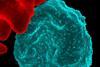 Malaria-infected_Red_Blood_Cell