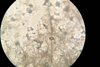 Low-Res_Aspergillus terreus microscope.jpg