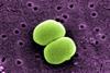 scanning-electron-micrograph-of-two-staphylococcus-epidermidis-bacteria-1536x904