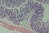 Low-Res_sonnenberg_immunity061125_crop