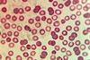 Plasmodium_in_erythrocytic_cycle