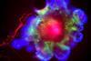 Low-Res_Organoid-teaser-1200x628-UCSDHS