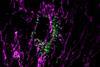 Low-Res_rehman-lab-mitokeima-hlmvec-oa-maggreen