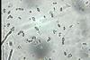 Микроконидии_од_Fusarium_sp