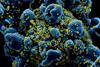 Novel_Coronavirus_SARS-CoV-2_(49680384281)