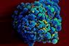 HIV-infected_H9_T_cell_(6813396647)