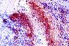 adaptiveimage.resize