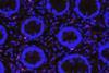 Low-Res_Kim P Feb 24 CMV in Human Intestines