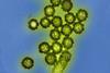 H1N1_Influenza_Virus_Particles_(8411599236)