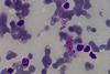 Amastigotes_of_Leishmania_donovani (1)