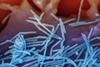 Human_Respiratory_Syncytial_Virus_(RSV)_-_52453988775