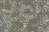 Low-Res_Acanthamoeba
