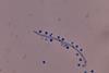 LPCB_Mount_of_Cryptococcus_growth_on_SDA_microscopic_footage