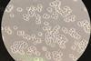 Saccharomyces_cerevisiae_100x_phase-contrast_microscopy2 (1)