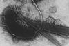 960px-Vibrio_cholerae (1)