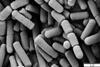 Bacillus_cereus_SEM-cr