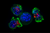 Killer_T_cells_surround_a_cancer_cell