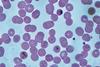 Malaria_falciparum_ring_forms