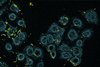 Lung_cells_infection_by_Pseudomonas_aeruginosa.tif