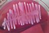 Klebsiella_pneumoniae_mucoid_colony_on_Macconkey_medium