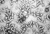 Hepatitis-B_virions