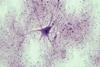 Nervous_Tissue_Spinal_Cord_Motor_Neuron_(41850849912)