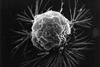 Breast_cancer_cell_(2)