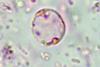 Parasite140080-fig2_Gastrointestinal_parasites_in_seven_primates_of_the_Taï_National_Park_-_Blastocystis
