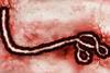 B virus