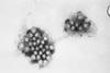 Norovirus_EM_PHIL_2172_lores
