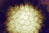 Herpes simplex virus