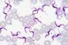 Trypanosoma-evansi-rat-blood-Giemsa-stain