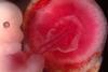 Fetus_and_placenta_-_journal.pbio.0060312.g001