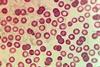 Plasmodium_in_erythrocytic_cycle