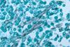 Zygomycosis_caused_by_Mucor_pusillus_PHIL_4234_lores